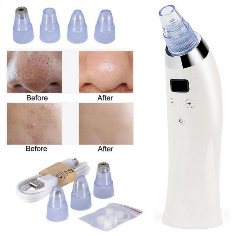 Extractor De Espinillas Puntos Negros